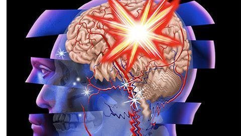 MRI-Determined Brain Volume Can Predict PTSD