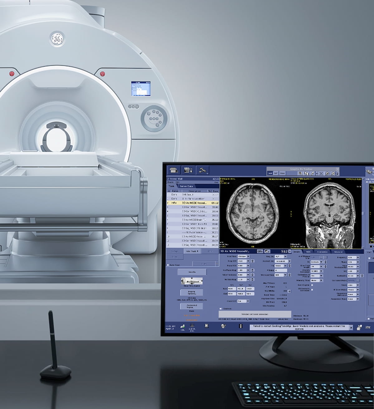 Reportedly offering enhanced imaging detail of the brain’s function, microstructure, and microvasculature, the head-only 3T MRI system Signa Magnus provides higher b-value diffusion with short echo times, according to GE HealthCare, the manufacturer of the device. (Photo courtesy of GE HealthCare.)