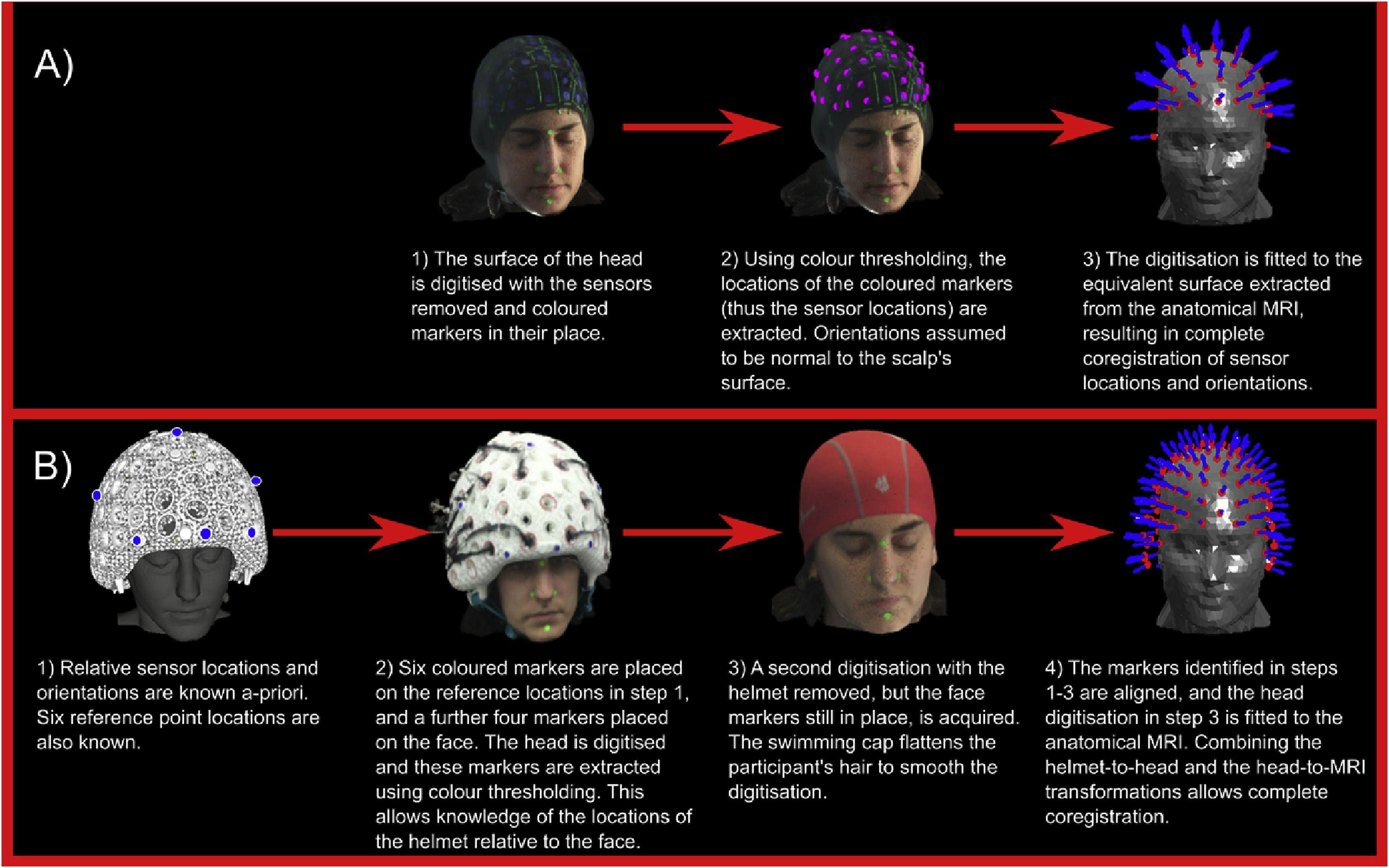 Wearable Brain Scanner Prototype Can Scan Entire Brain During Movement