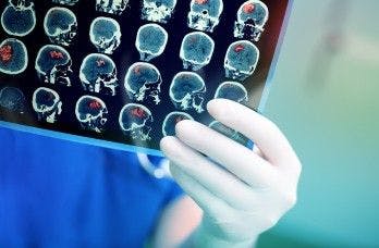 MRI Shows Contact Sports Affect Brain Long-Term