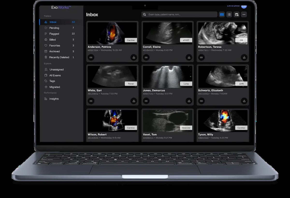 Exo Launches Point-Of-Care Ultrasound Package Exo Works Connect 