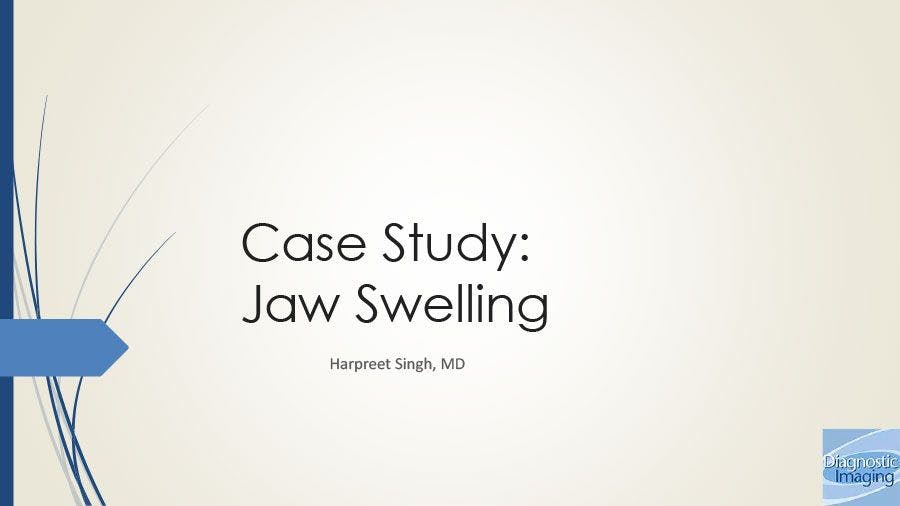 Jaw Swelling