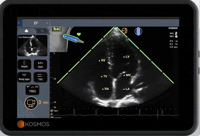 Cardiac Ultrasound Update: FDA Clears Software with 45 Automated Parameters for Echocardiographic Analysis