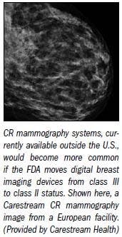 FDA slammed for slow action on digital mammo approval