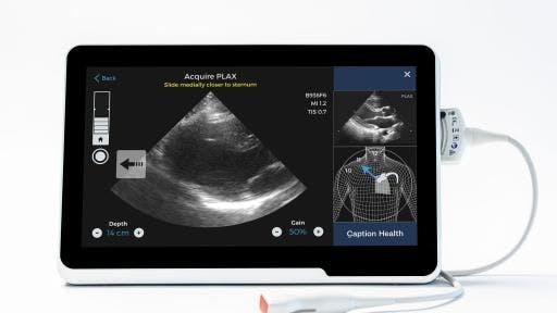 FDA Clears Path for First AI-Guided Cardiac Ultrasound Software System
