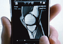 Apple hypes iPhone radiology application