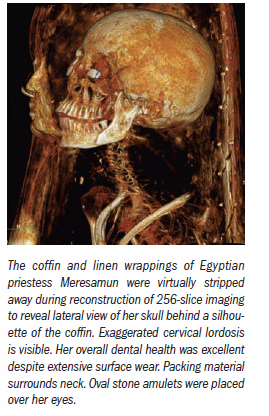 Serial mummy scans capture CT advances