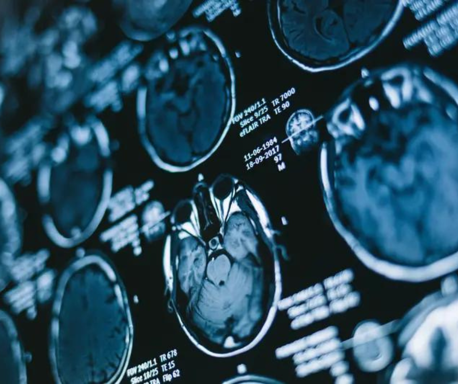 Study Says MRI Offers Most Cost-Effective Imaging for Dizziness Presentations in the ER