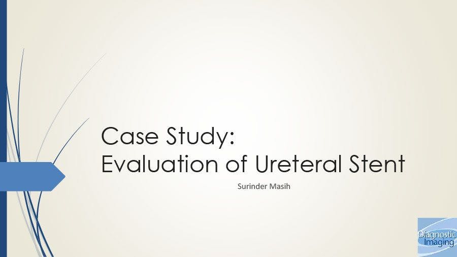 Evaluation of Ureteral Stent