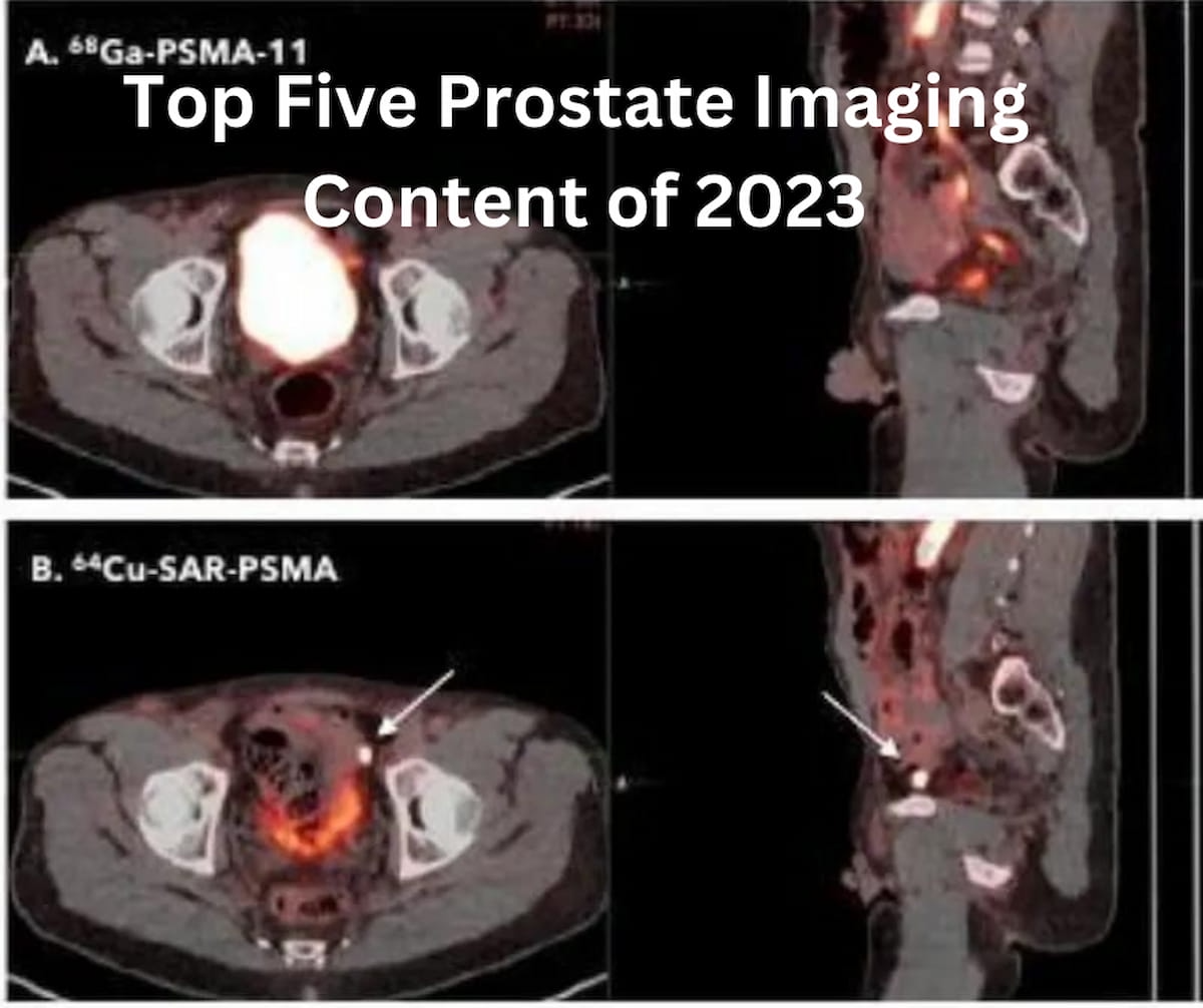 Diagnostic Imaging's Top Five Prostate Imaging Content of 2023