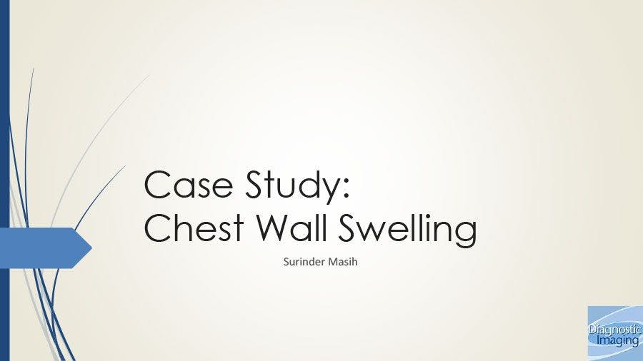 Chest Wall Swelling