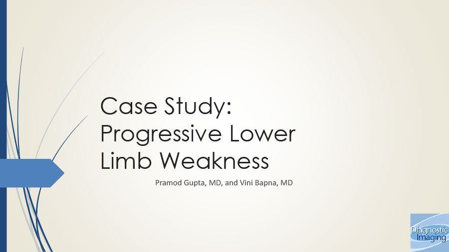 Progressive Lower Limb Weakness