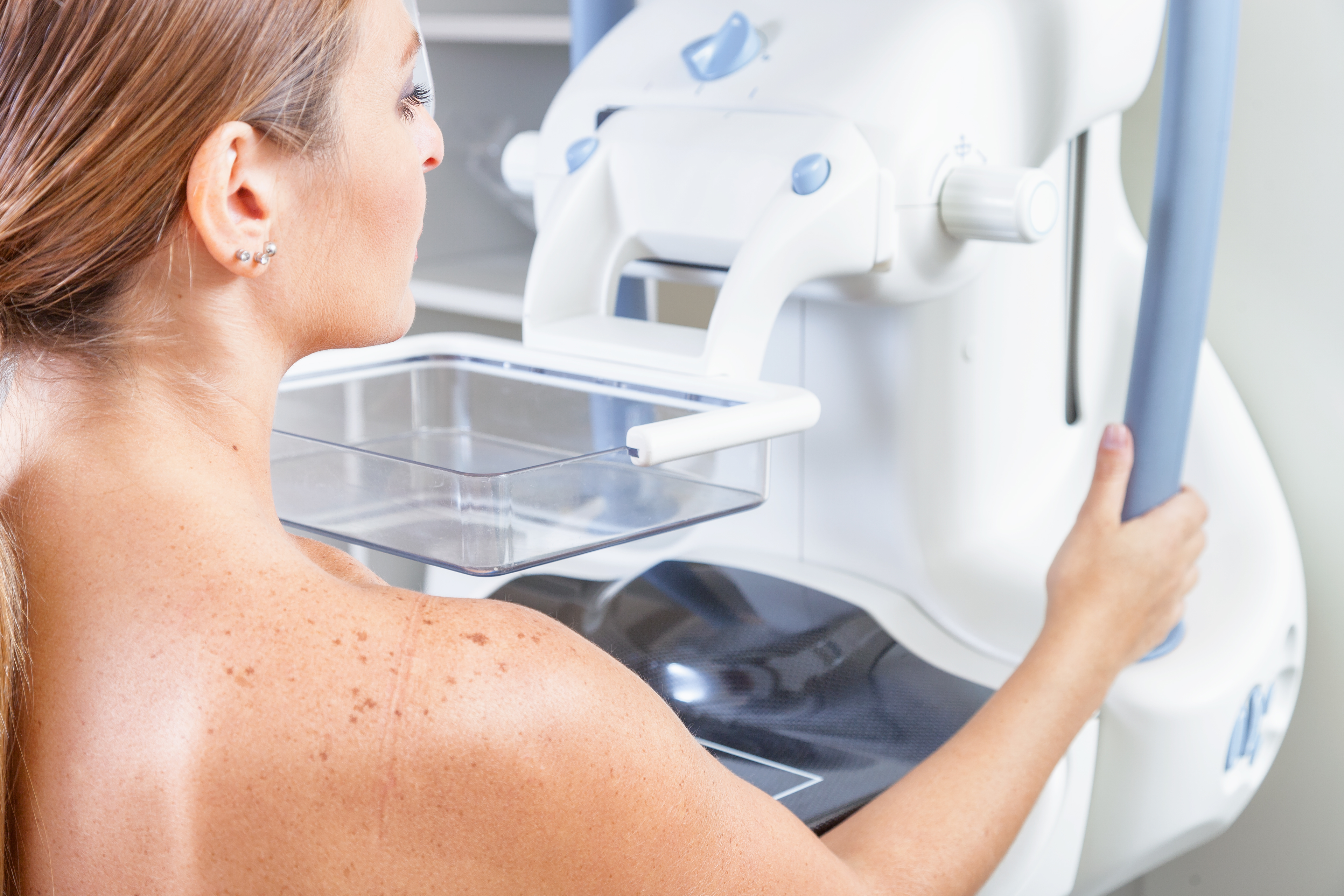 New Mammography Study Reveals Mixed Awareness on Breast Cancer Risks