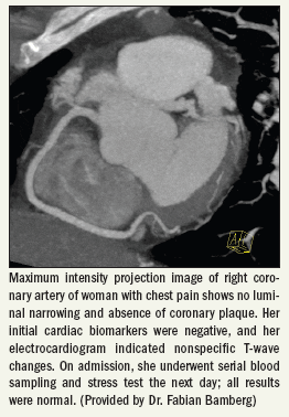 Multislice CT carves niche inemergency cardiovascular triag