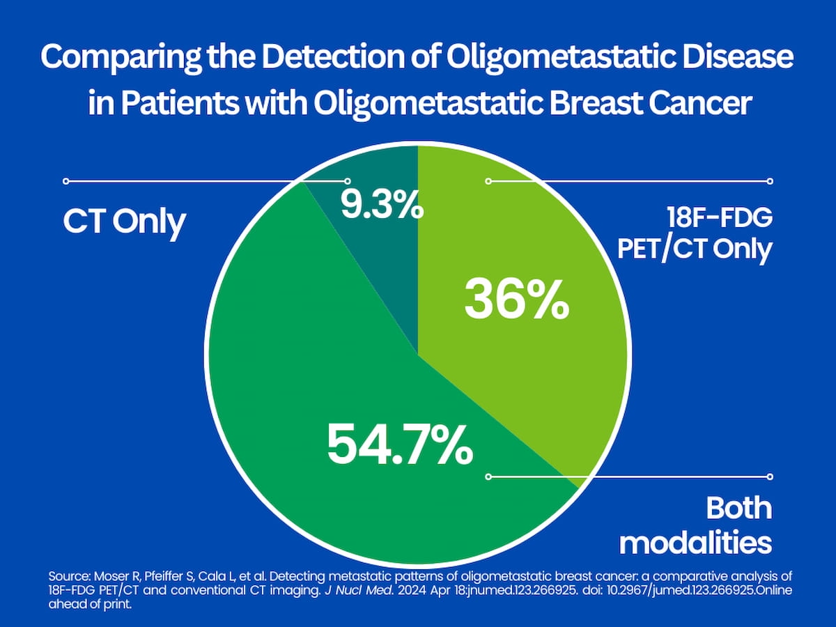 PET/CT Shows Superior Results for Oligometastatic Breast Cancer in Comparison to CT