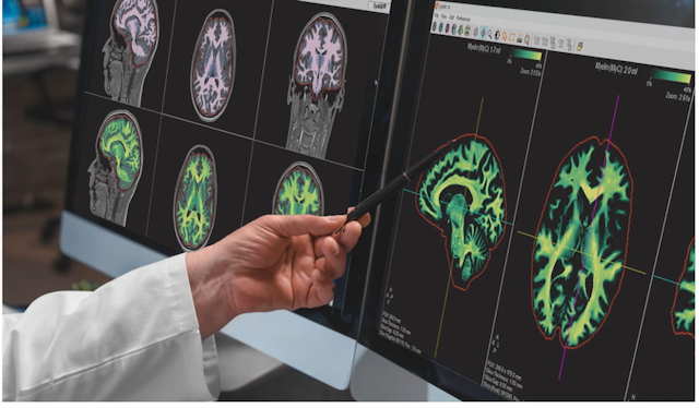 3D MRI for Quantitative Brain Imaging Gets FDA Nod