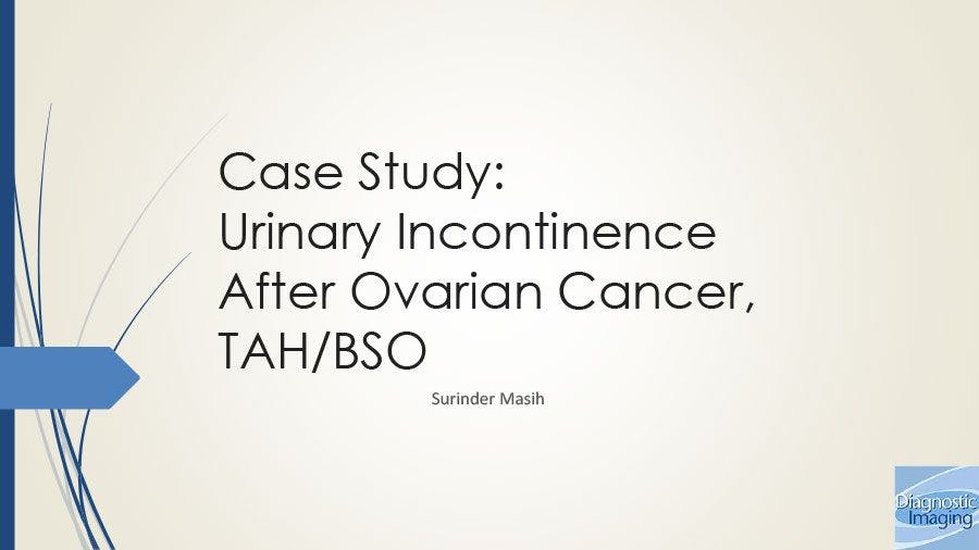 Urinary Incontinence After Ovarian Cancer, TAH/BSO