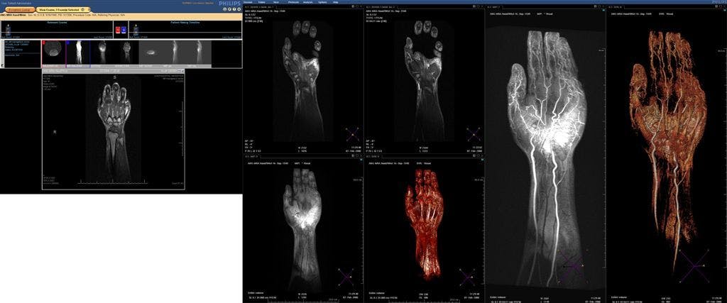 PACS vendors forge tools for distributed radiology services