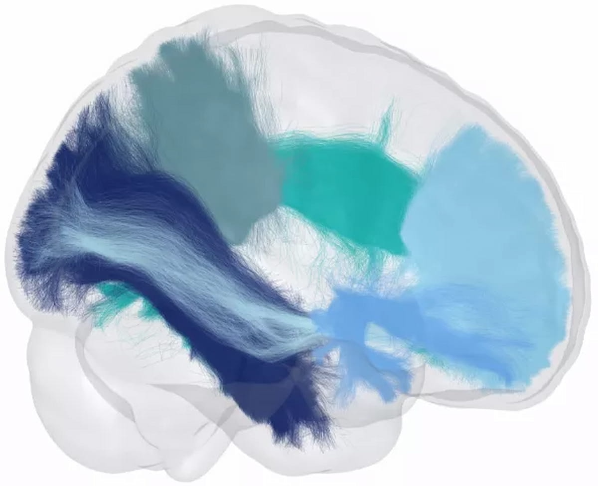 FDA Clears Adjunctive AI Mapping of White Matter on Diffusion MRI