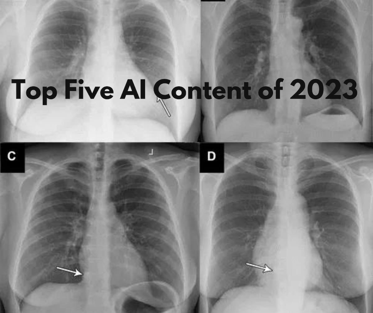 Diagnostic Imaging's Top Five AI Content of 2023