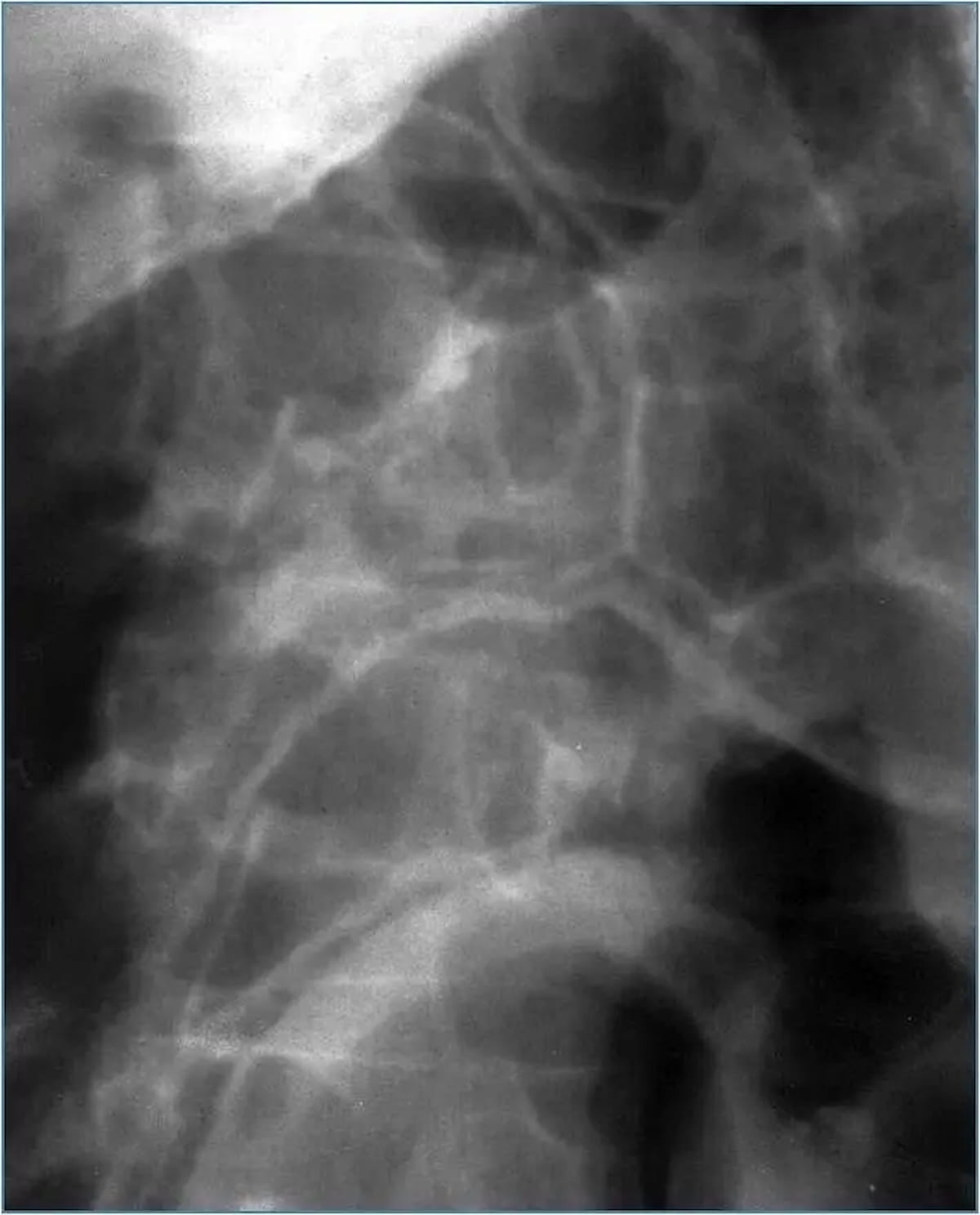 Image IQ Quiz: 42-Year-Old Patient with Acute Abdominal Pain and Fever