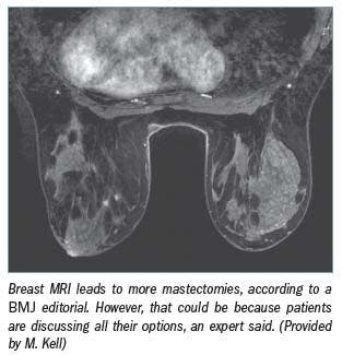 Debate over mastectomy/breast MR link continues