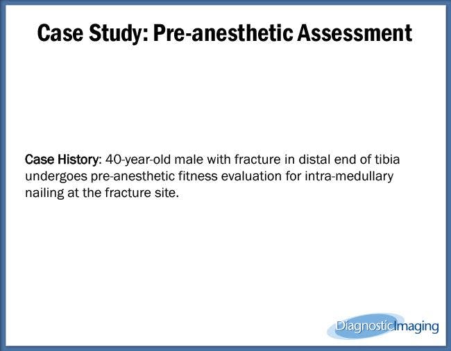 Pre-anesthetic Assessment