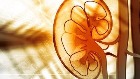 Reduced-Dose CT Effective for Kidney Stone Imaging
