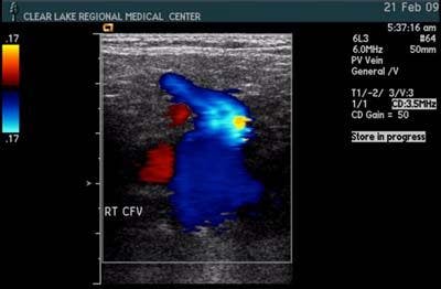 Easter Bunny appears in vascular ultrasound exam