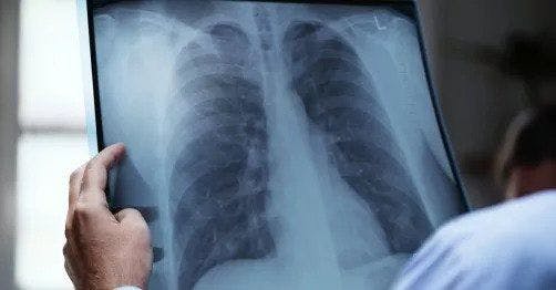 Who’s going to read the X-rays? (And, who wants to?)