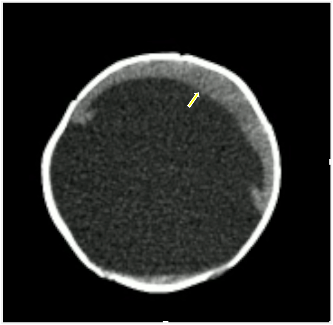 Image IQ Quiz: Six-Month-Old Infant with Developmental Delay