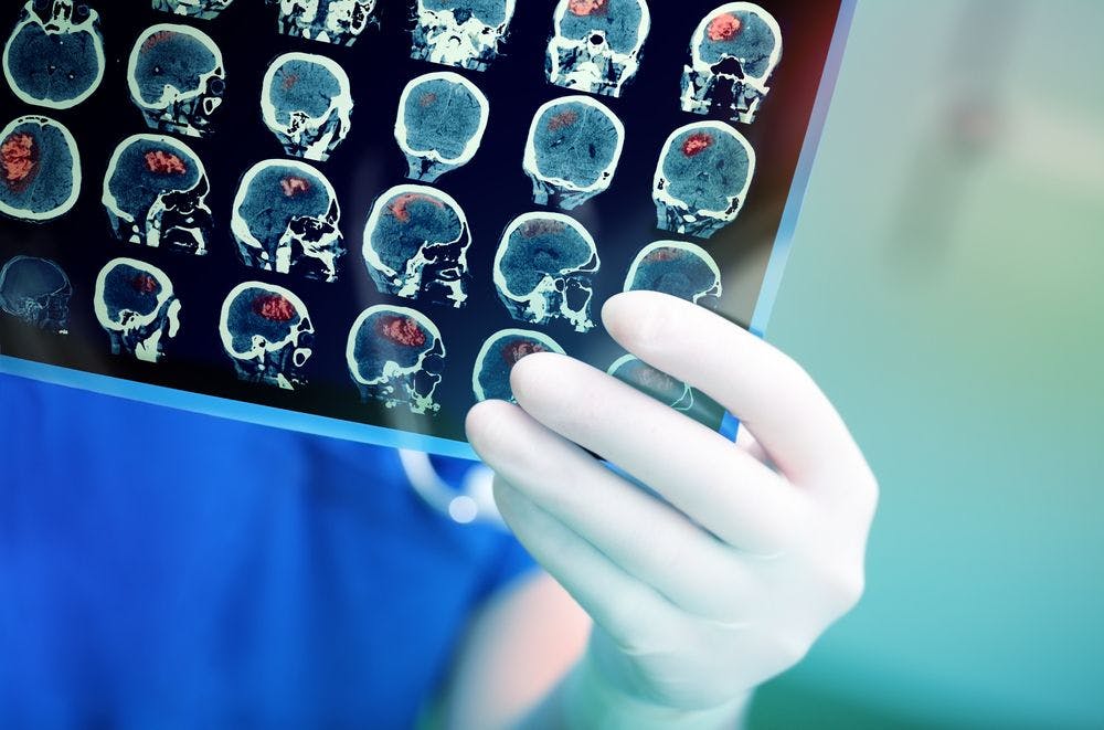 Ultra-Fast MRI Is Effective in Acute Neurological Emergency Diagnoses