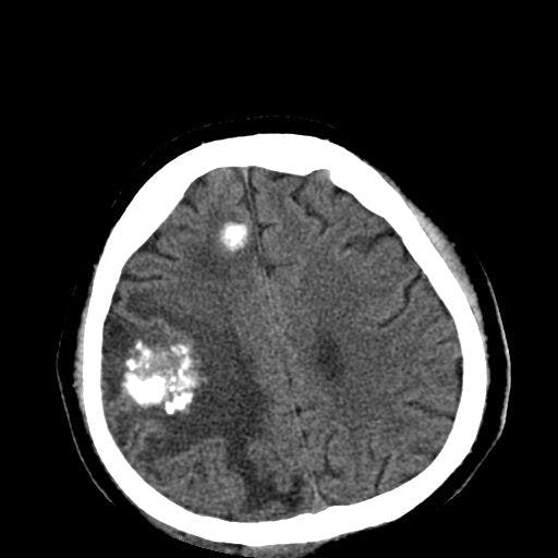 Image IQ: 16-year-old Southeast Asian Immigrant Has Seizure