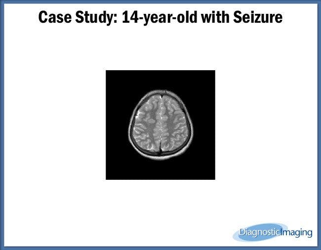 14 year-old with Seizure