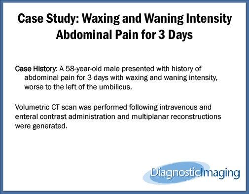 Waxing and Waning Intensity Abdominal Pain for 3 Days