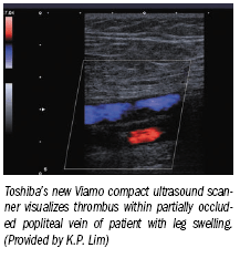 Philips, Toshiba enter hand-carried ultrasound market