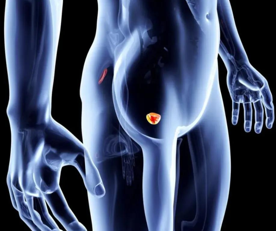 Low-Risk Prostate Cancer: Has Active Surveillance Become the New Standard of Care?