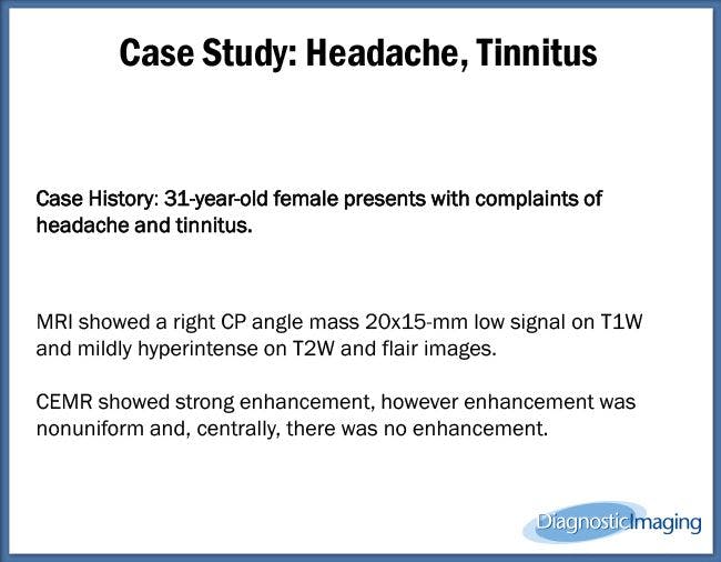 Headache, Tinnitus