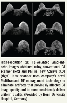 Research study validates use of BI-RADS in breast MRI