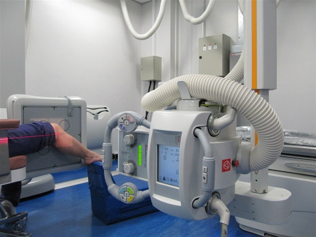 Digital radiography wins over emergency room in U.K. setting