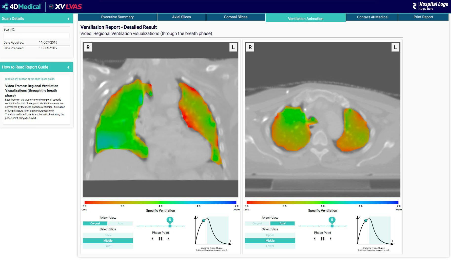 FDA Awards Clearance to 4D Lung Imaging Software