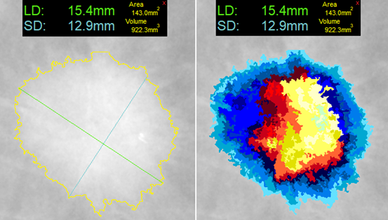 At left, one-click segmentation and measurement rendered by DL Precise. At right, DL Precise uses vivid color to illustrate segmentation.

Credit: DeepLook