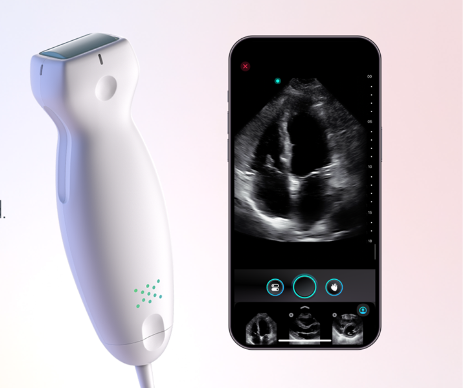 Exo Debuts New Point-of-Care Ultrasound Modality 