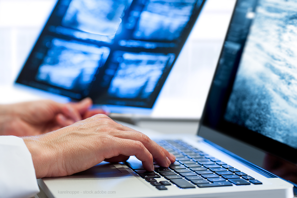 Artificial Intelligence & Mammography: Where It’s Been & Where It’s Going 