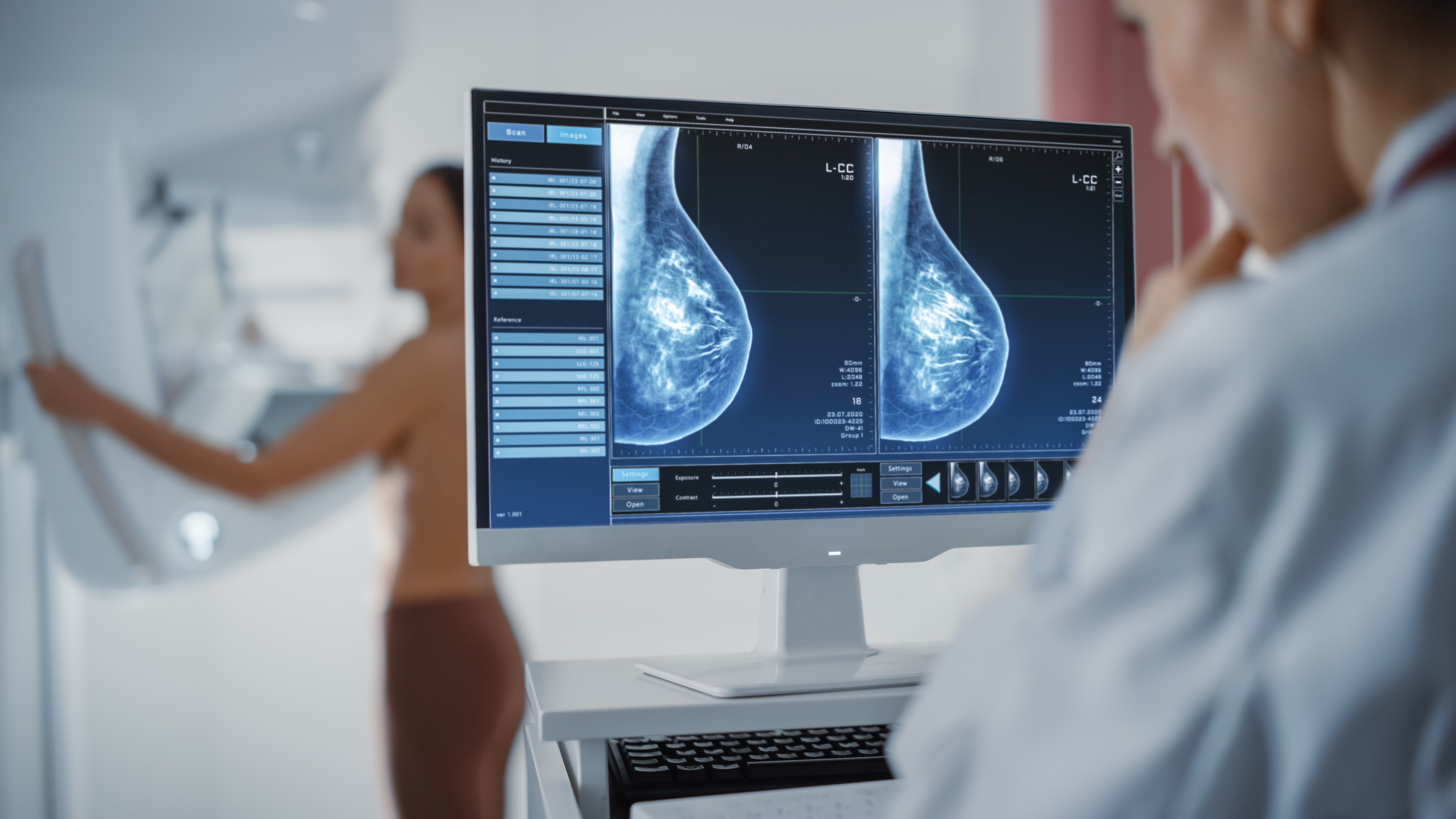 Mammography Study Shows 22 Percent Higher Incidence of Dense Breasts in Women with a Family History of Breast Cancer