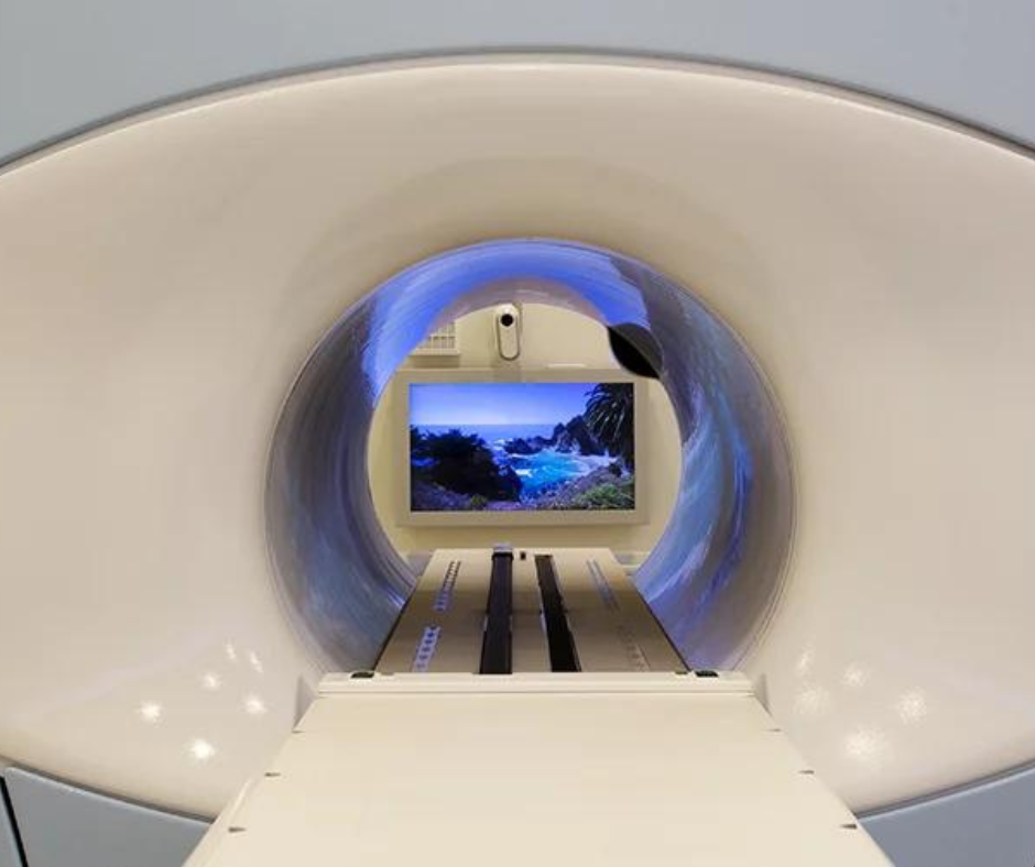 Radiotherapy for Prostate Cancer: Study Says MRI Guidance Significantly Reduces GU and GI Toxicities