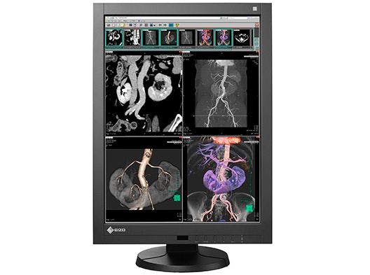 6 Innovative High-Performance Displays for Radiology