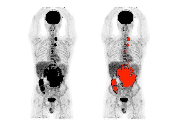 GE Healthcare Backs Whole-Body Imaging PET/CT Collaboration