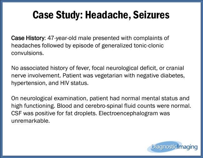 Headache, Seizures