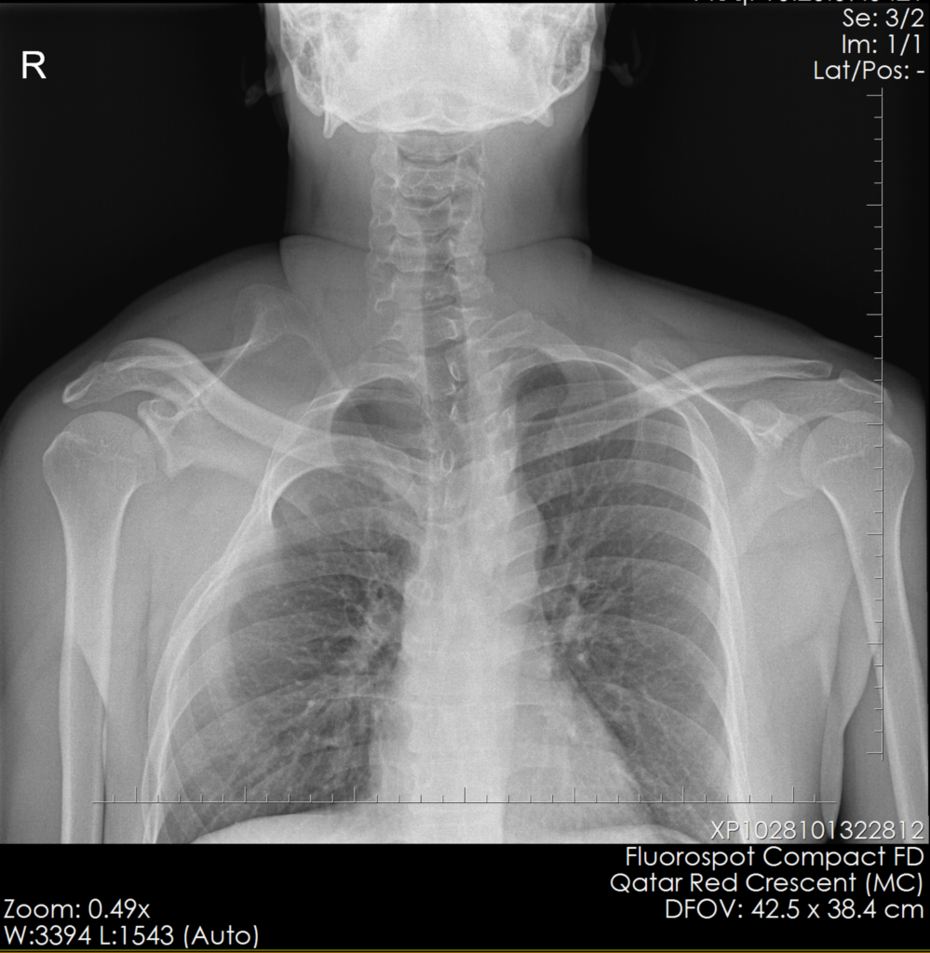 Image IQ Quiz: Patient Presents for an Evaluation of Scoliosis